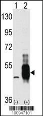 Anti-MAP3K8 Rabbit Polyclonal Antibody