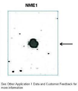 Anti-NME1 Rabbit Polyclonal Antibody