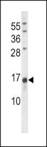 Anti-Osteocalcin Rabbit Polyclonal Antibody