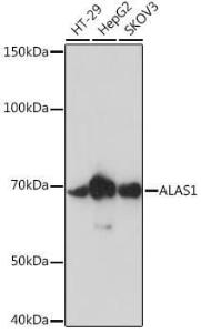 Western blot analysis of extracts of various cell lines, using Anti-Alas1 Antibody [ARC0239] (A308881) at 1:1,000 dilution