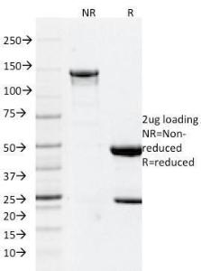 SDS-PAGE analysis of Anti-GFAP Antibody [GFAP/2076] under non-reduced and reduced conditions; showing intact IgG and intact heavy and light chains, respectively SDS-PAGE analysis confirms the integrity and purity of the antibody