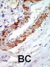 Anti-MAP3K8 Rabbit Polyclonal Antibody