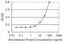 Anti-DSN1 Mouse Monoclonal Antibody [clone: 2A7]