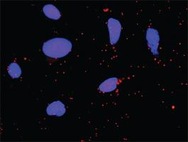 Anti-FGA + F2 Antibody Pair