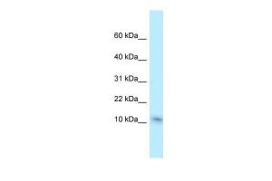 Anti-NME1 Rabbit Polyclonal Antibody