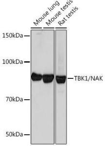 Western blot analysis of extracts of various cell lines, using Anti-NAK / TBK1 Antibody [ARC0778] (A307679) at 1:1,000 dilution. The secondary antibody was Goat Anti-Rabbit IgG H&L Antibody (HRP) at 1:10,000 dilution.