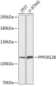 Western blot analysis of extracts of various cell lines, using Anti-PPP1R12B Antibody (A308884) at 1:1,000 dilution. The secondary antibody was Goat Anti-Rabbit IgG H&L Antibody (HRP) at 1:10,000 dilution.