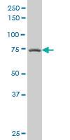 Anti-PRKCB Mouse Polyclonal Antibody