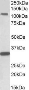 Anti-KIT Goat Polyclonal Antibody