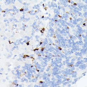 Immunohistochemistry analysis of paraffin-embedded mouse brain using Anti-Somatostatin Antibody [ARC50670] (A308885) at a dilution of 1:200(40x lens)