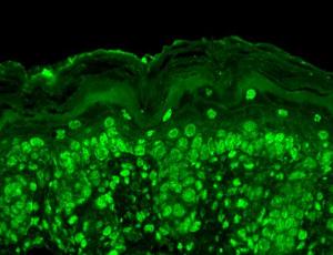 Immunohistochemistry analysis of mouse backskin, fixed in Bouin's fixative solution and paraffin-embedde