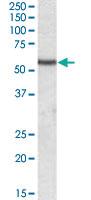 Anti-DES Goat Polyclonal Antibody