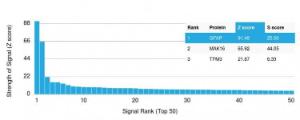 Analysis of protein array containing more than 19,000 full-length human proteins using Anti-GFAP Antibody [GFAP/2076] Z-Score and S- Score