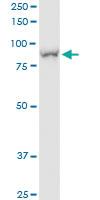 Anti-H6PD Polyclonal Antibody Pair