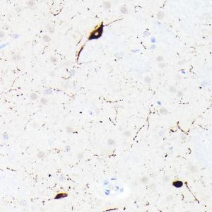 Immunohistochemistry analysis of paraffin-embedded rat brain using Anti-Somatostatin Antibody [ARC50670] (A308885) at a dilution of 1:200(40x lens)