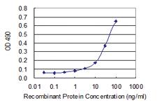 Anti-SUGT1 Polyclonal Antibody Pair