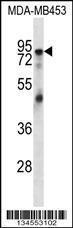 Anti-EWSR1 Rabbit Polyclonal Antibody (PE (Phycoerythrin))