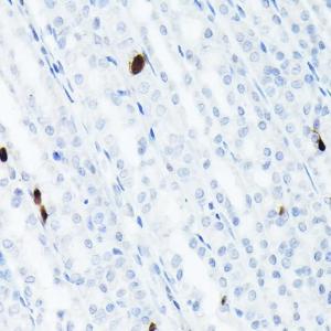 Immunohistochemistry analysis of paraffin-embedded rat stomach using Anti-Somatostatin Antibody [ARC50670] (A308885) at a dilution of 1:200(40x lens)