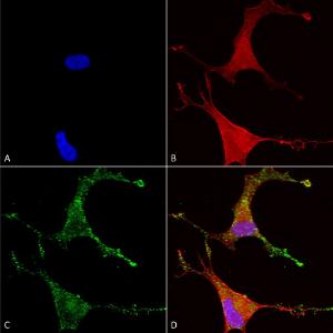 Immunocytochemistry/Immunofluorescence analysis of human neuroblastoma cells (SH-SY5Y), fixed in 4% PFA for 15 min, using Anti-CACNB2 Antibody [N8b/1] (A304748), at 1:50 for overnight at 4°C with slow rockin