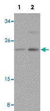 Anti-CABP7 Rabbit Polyclonal Antibody