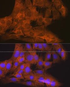 Immunofluorescence analysis of C6 cells using Anti-NAK / TBK1 Antibody [ARC0778] (A307679) at a dilution of 1:100 (40x lens). DAPI was used to stain the cell nuclei (blue).