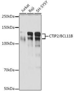 Western blot analysis of extracts of various cell lines, using Anti-Ctip2 Antibody [ARC2329] (A308886) at 1:1,000 dilution. The secondary antibody was Goat Anti-Rabbit IgG H&L Antibody (HRP) at 1:10,000 dilution.