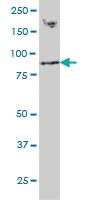 Anti-RNF139 Mouse Monoclonal Antibody [clone: 3D10]