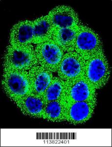 Anti-CDKN2B Rabbit Polyclonal Antibody (HRP (Horseradish Peroxidase))