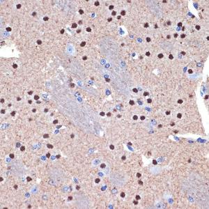 Immunohistochemistry analysis of paraffin-embedded mouse brain using Anti-Ctip2 Antibody [ARC2329] (A308886) at a dilution of 1:100 (40x lens). Perform microwave antigen retrieval with 10 mM Tris/EDTA buffer pH 9.0 before commencing with IHC staining protocol.