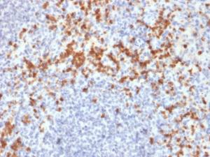 Anti-MMP9 Mouse Monoclonal Antibody [clone: SPM425]