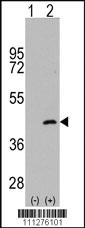 Anti-MAP2K4 Rabbit Polyclonal Antibody