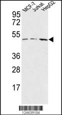 Anti-HAPLN1 Rabbit Polyclonal Antibody