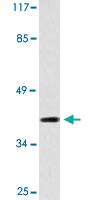 Anti-HTR1E Rabbit Polyclonal Antibody