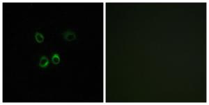 Immunofluorescence analysis of MCF7 cells using Anti-RGR Antibody. The right hand panel represents a negative control, where the antibody was pre-incubated with the immunising peptide.