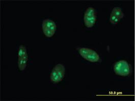 Anti-EXOSC5 Mouse Monoclonal Antibody [clone: 6G11]