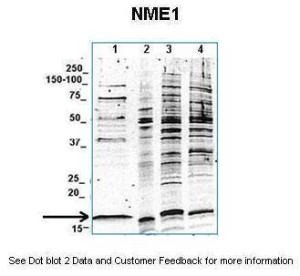 Anti-NME1 Rabbit Polyclonal Antibody