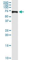 Anti-TRIM32 Polyclonal Antibody Pair