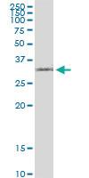 Anti-IRF1 Polyclonal Antibody Pair