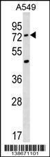 Anti-ACSM2A Rabbit Polyclonal Antibody (HRP (Horseradish Peroxidase))