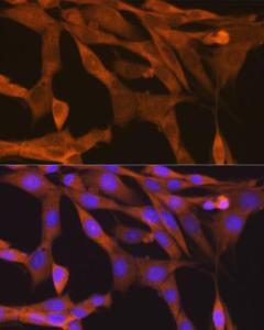 Immunofluorescence analysis of NIH-3T3 cells using Anti-NAK / TBK1 Antibody [ARC0778] (A307679) at a dilution of 1:100 (40x lens). DAPI was used to stain the cell nuclei (blue).