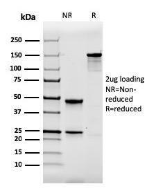 Anti-Calbindin antibody