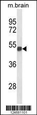 Anti-GLP2R Rabbit Polyclonal Antibody