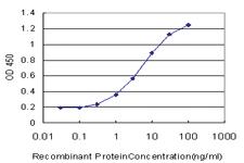 Anti-EXOSC5 Mouse Monoclonal Antibody [clone: 6G11]