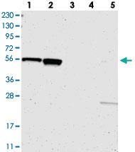 Anti-C17ORF80 Rabbit Polyclonal Antibody