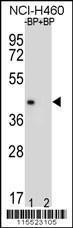 Anti-MBP Rabbit Polyclonal Antibody (APC (Allophycocyanin))