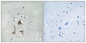 Immunohistochemical analysis of paraffin-embedded human brain tissue using Anti-RGR Antibody. The right hand panel represents a negative control, where the antibody was pre-incubated with the immunising peptide.