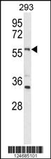 Anti-LMBR1L Rabbit Polyclonal Antibody