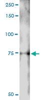 Anti-LIN9 Polyclonal Antibody Pair