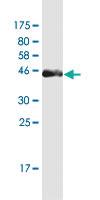 Anti-PAGE4 Mouse Monoclonal Antibody [clone: 7C3]