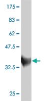 Anti-ZNF207 Mouse Monoclonal Antibody [clone: 6G11]